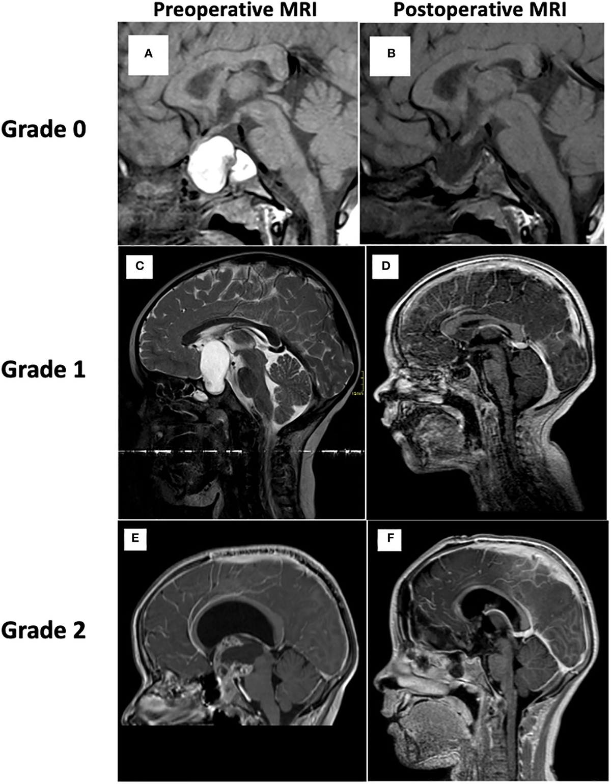 小児神経の画像診断 = Diagnostic Imaging of Infan… 小児神経の画像診断 = Diagnostic Imaging of Infan…