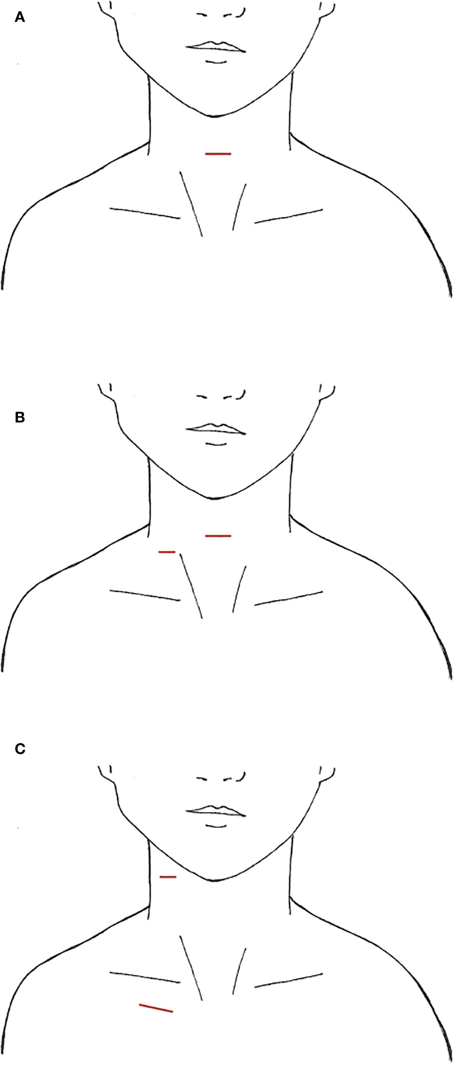 春先取りの | Frontiers A robotic and endoscopic of review scoping ぬいぐるみ