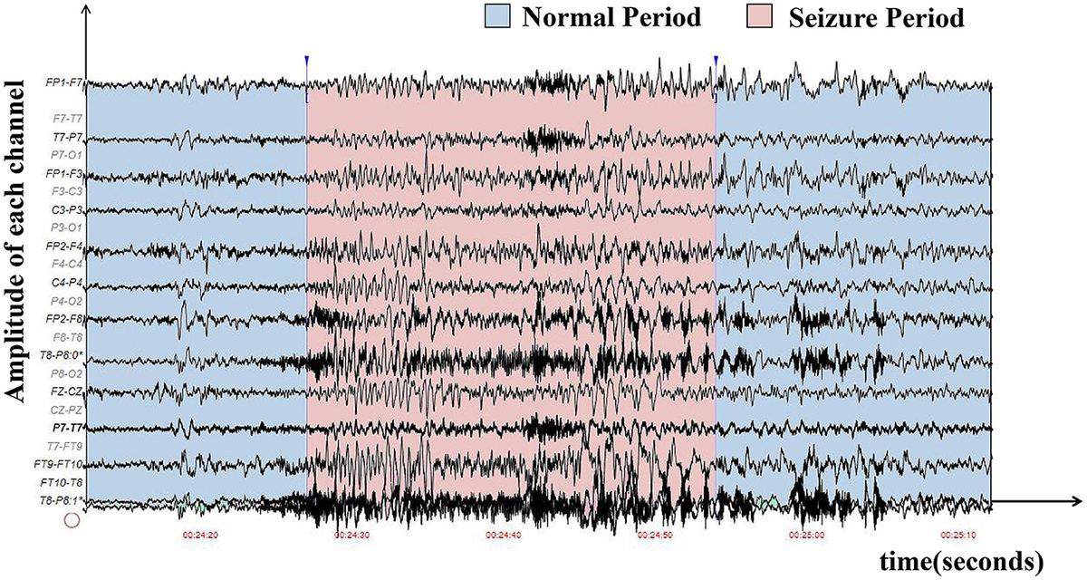 eeg 2012年 Frontiers | EEG and EMG dataset for the detection of errors