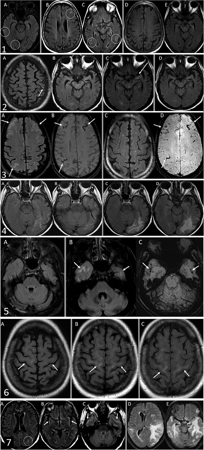 小児神経の画像診断 = Diagnostic Imaging of Infan… MEDSi)株式会社 メディカル・サイエンス・インターナショナル