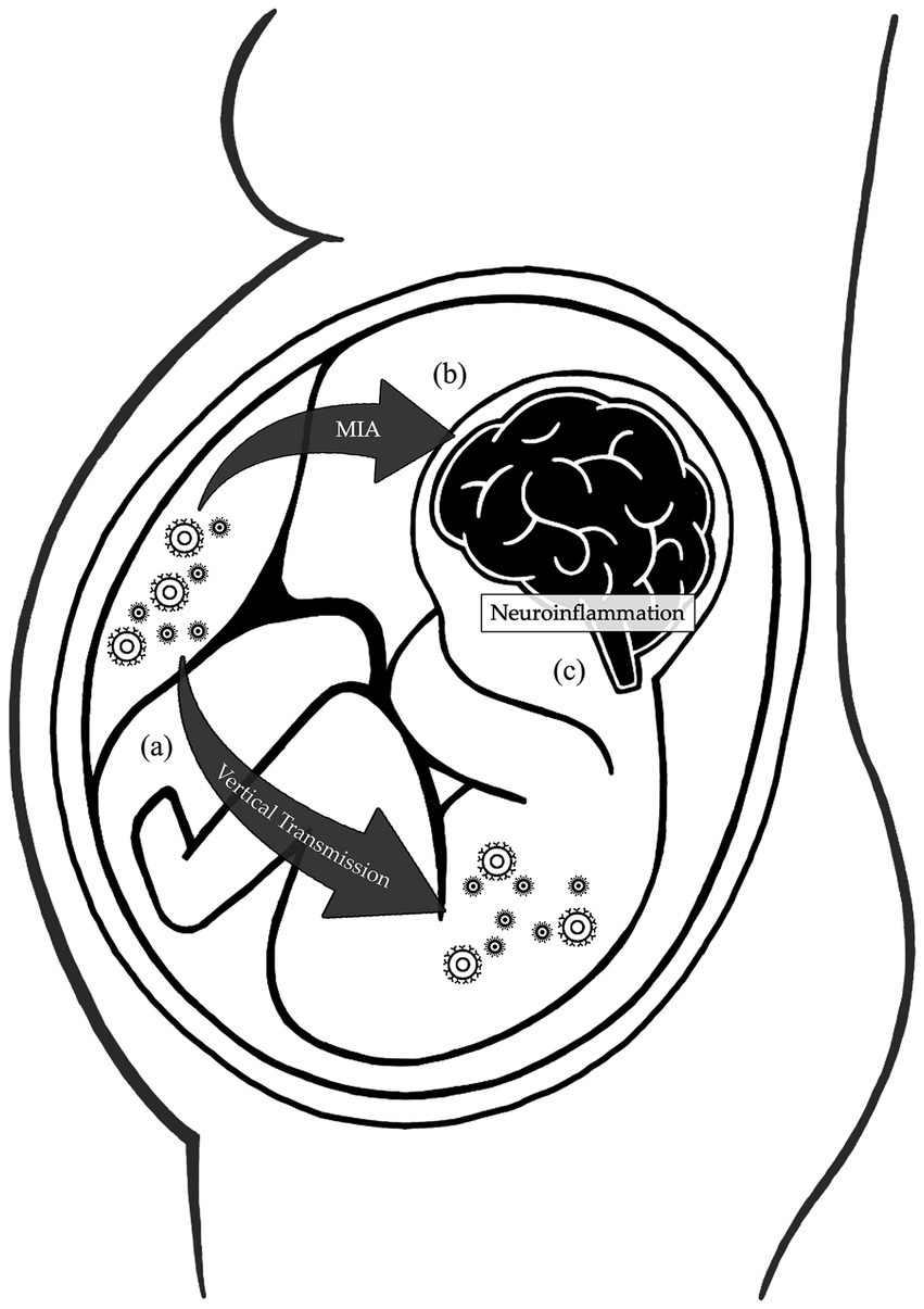 seri様 Mitochondrial mechanisms in the pathogenesis of chronic