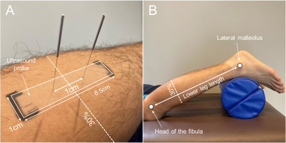 健康・医学 Electrophysiological Maneuvers
