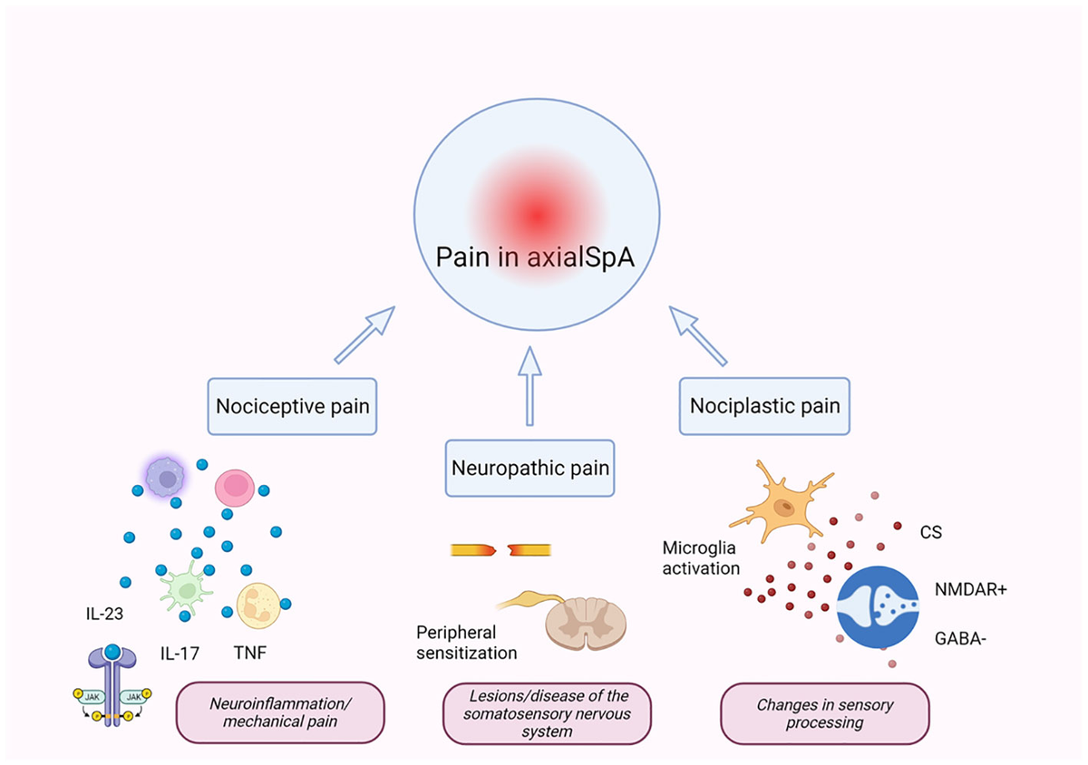 Frontiers | Pain in axial spondyloarthritis: role of the JAK