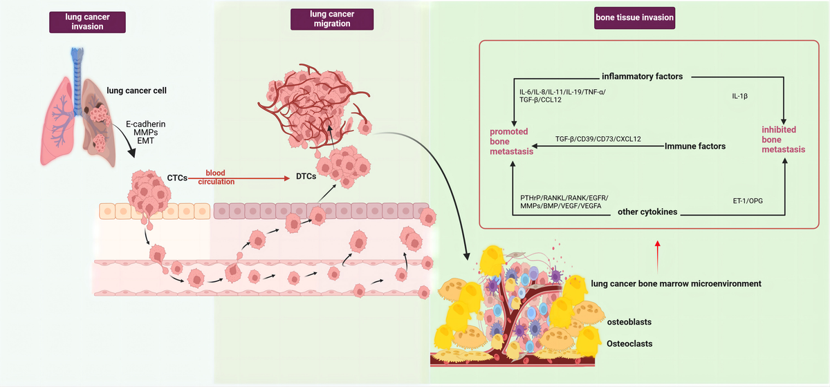 【2024最新】SNSで話題・人気の商品のおすすめアイテム Frontiers | bone cancer lung and adipocytes marrow Bone ウェア