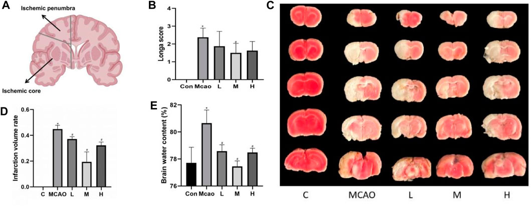 Frontiers | Apigenin protects against ischemic stroke by
