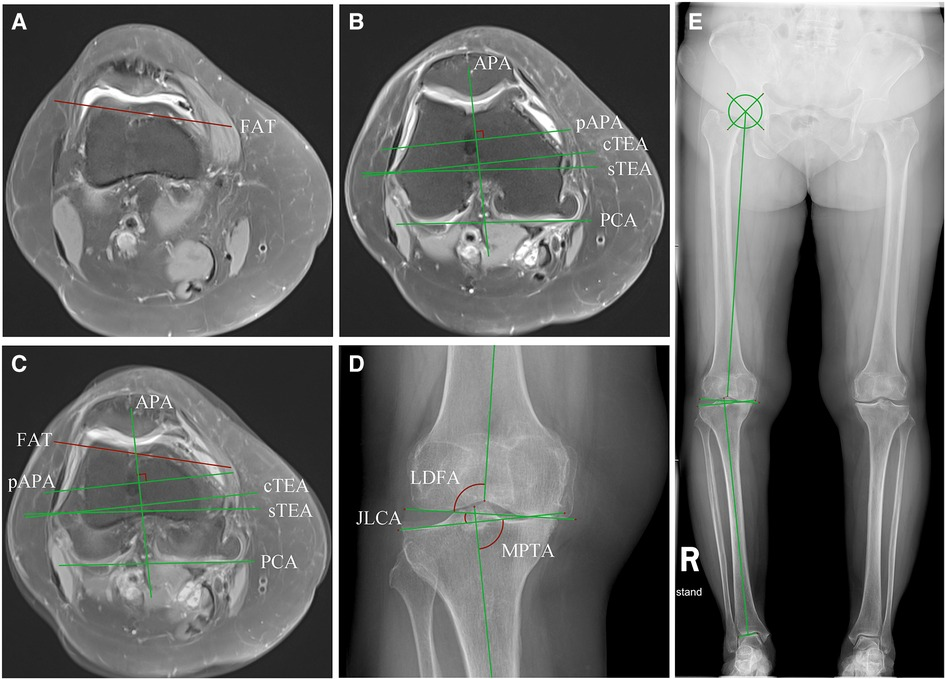 Ayolni qiyshiq sikli sikish