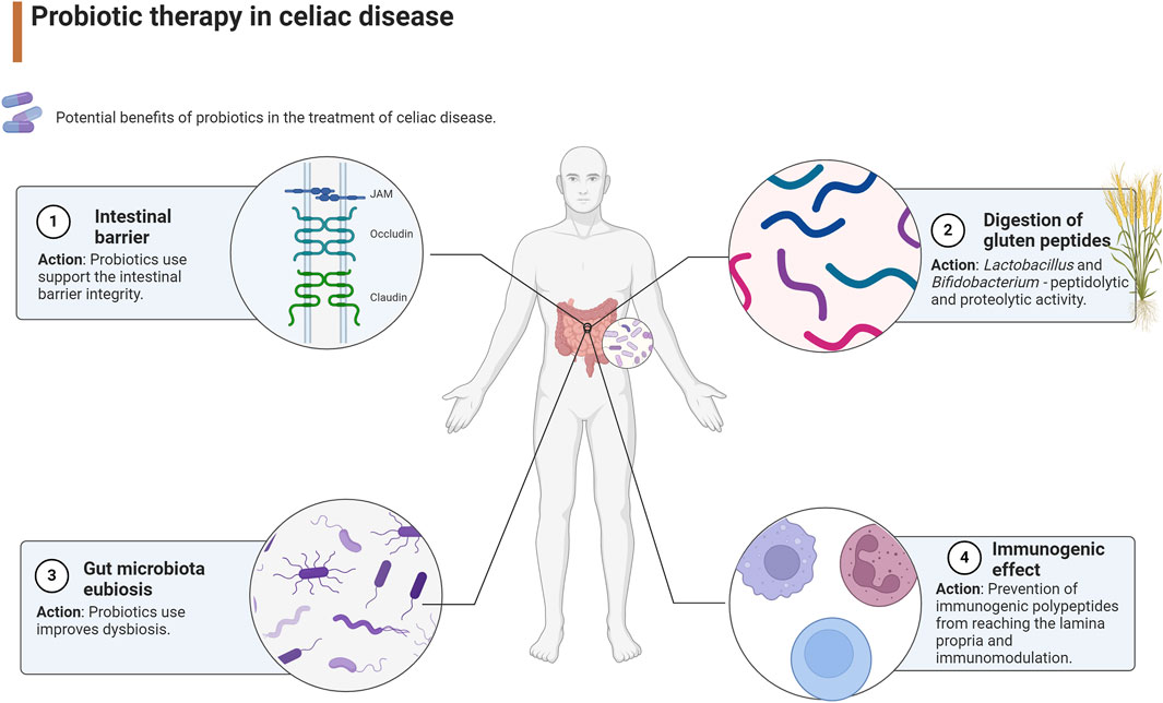 Frontiers | From an understanding of etiopathogenesis to