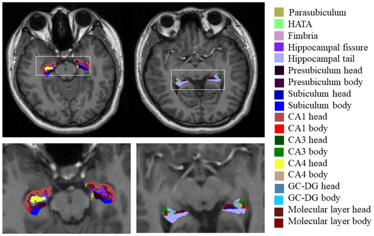 Muscle Diseases (神経学) Muscle Diversity, Heterogeneity, and Gradients: Learning