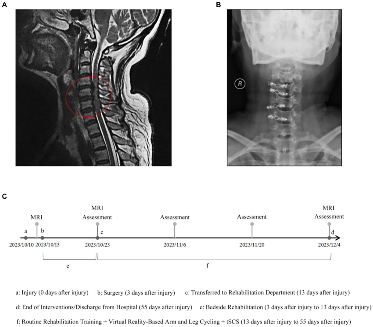 Despicable role of epithelial–mesenchymal transition in