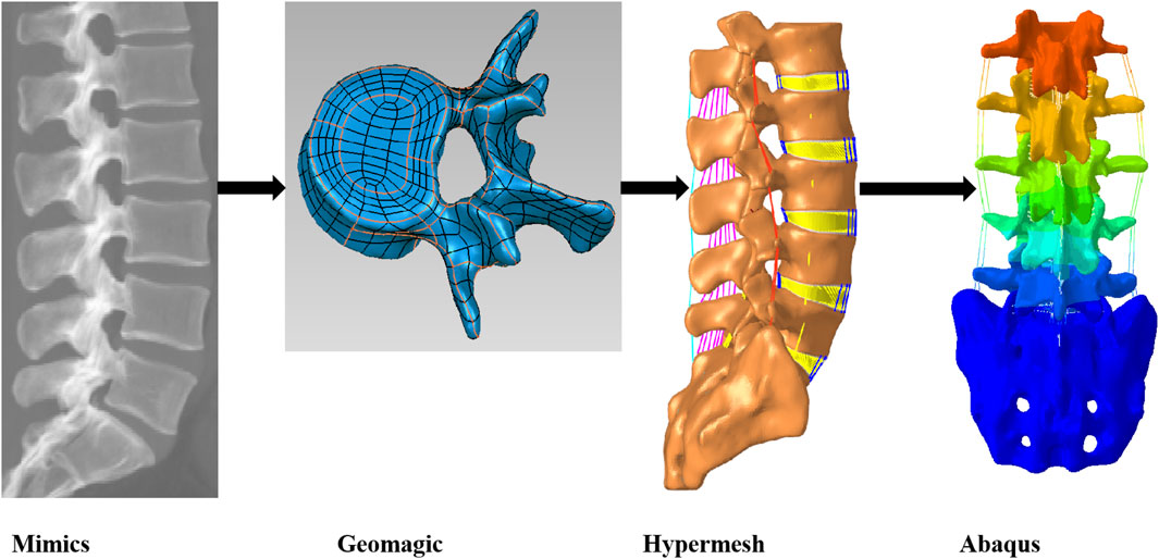 Frontiers | The impact of disc degeneration on the dynamic