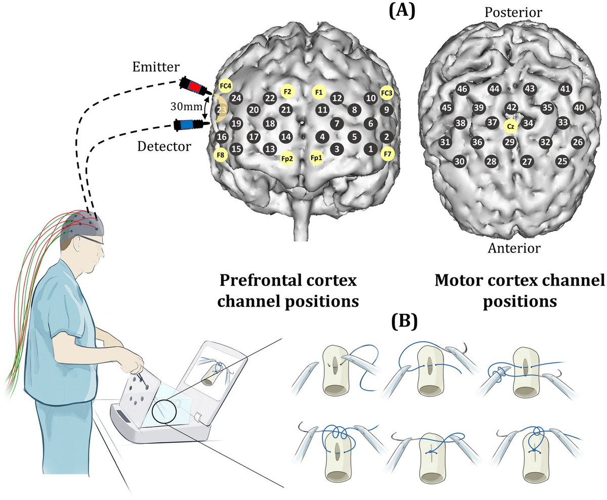Frontiers | Investigating the impact of mental rehearsal on