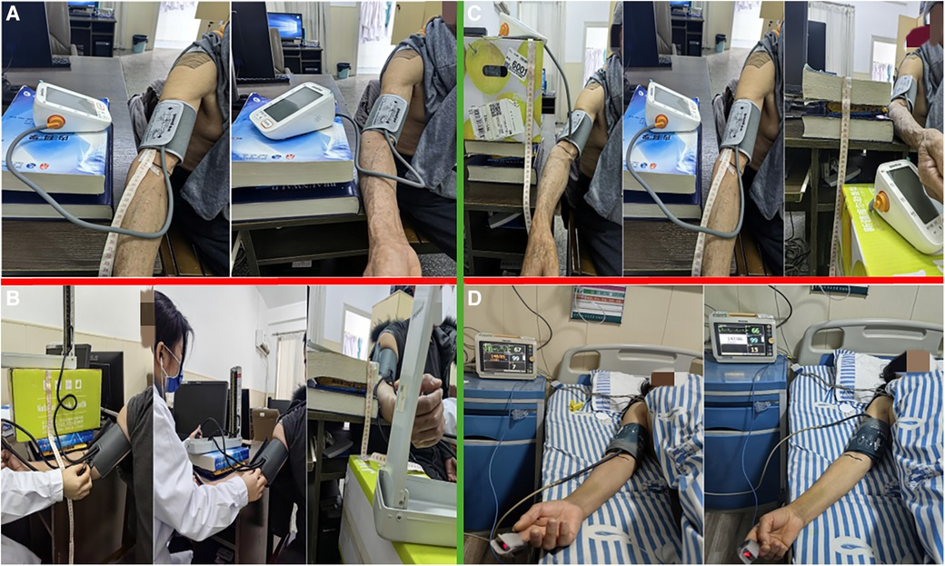 Frontiers The impact of sphygmomanometer placement and cuff placement