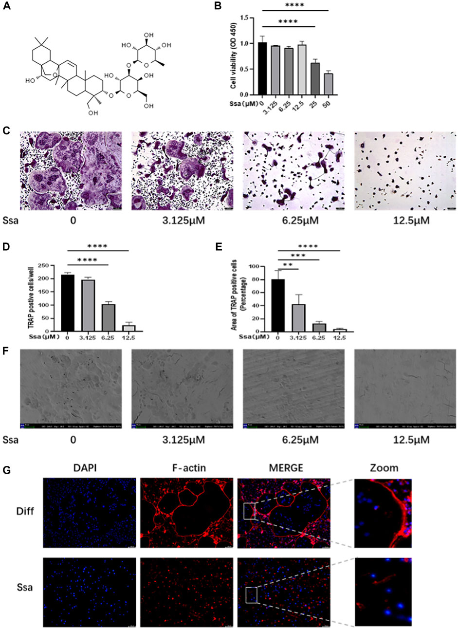 Frontiers | Saikosaponin A attenuates osteoclastogenesis and