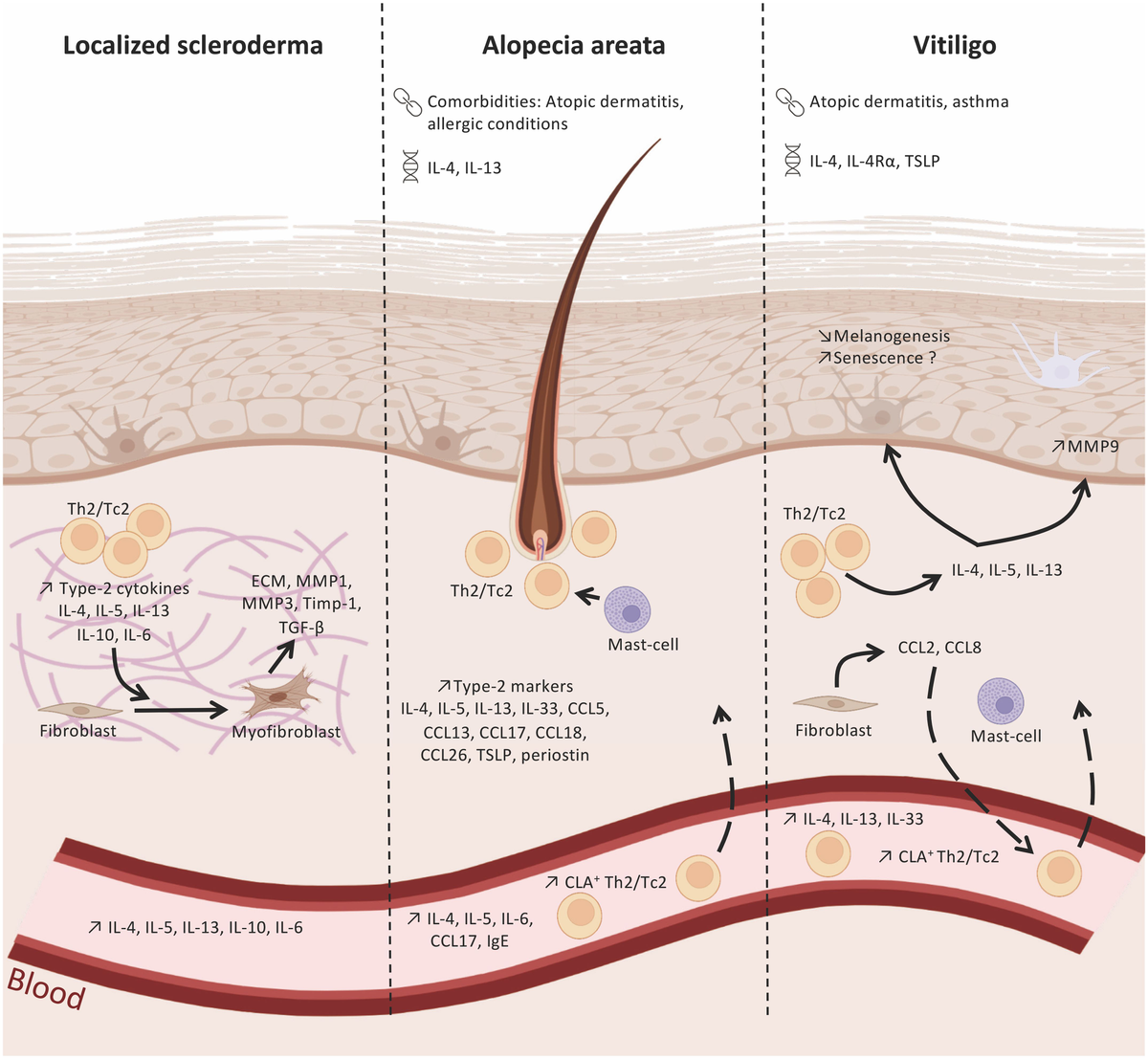 Frontiers | Type-2 immunity associated with type-1 related