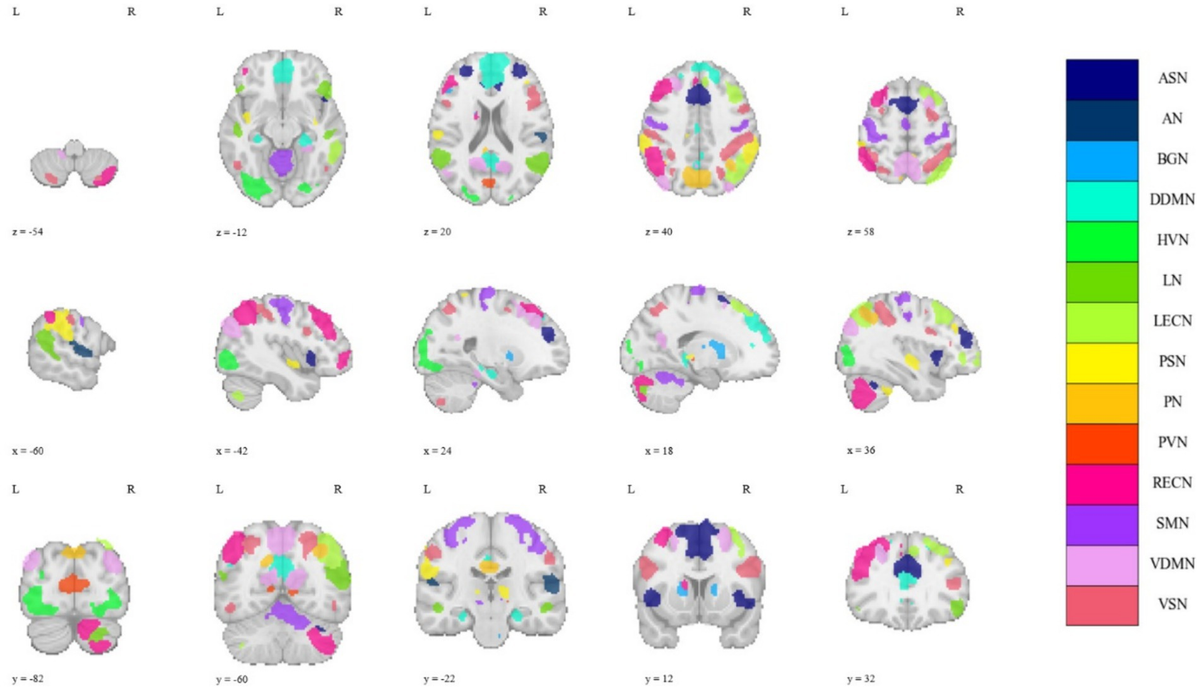 Frontiers | Rich-club organization of whole-brain spatio