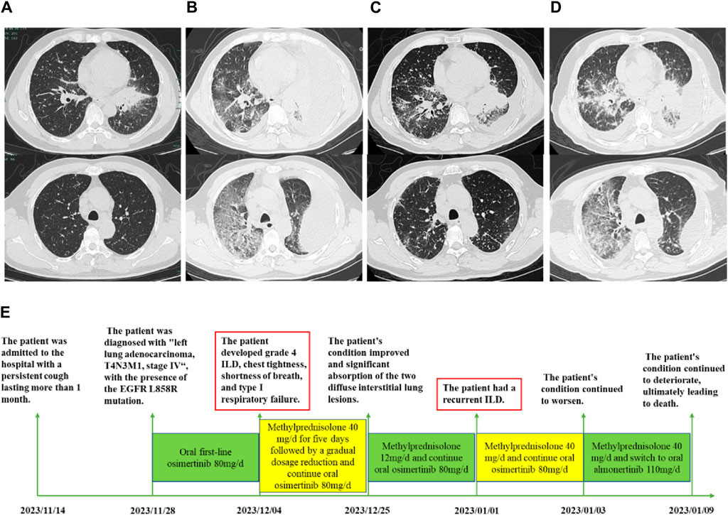 Frontiers | Case report: EGFR-TKI rechallenge after