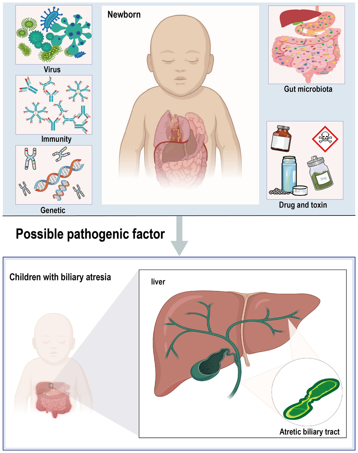 Frontiers | Biliary atresia: the role of gut microbiome, and