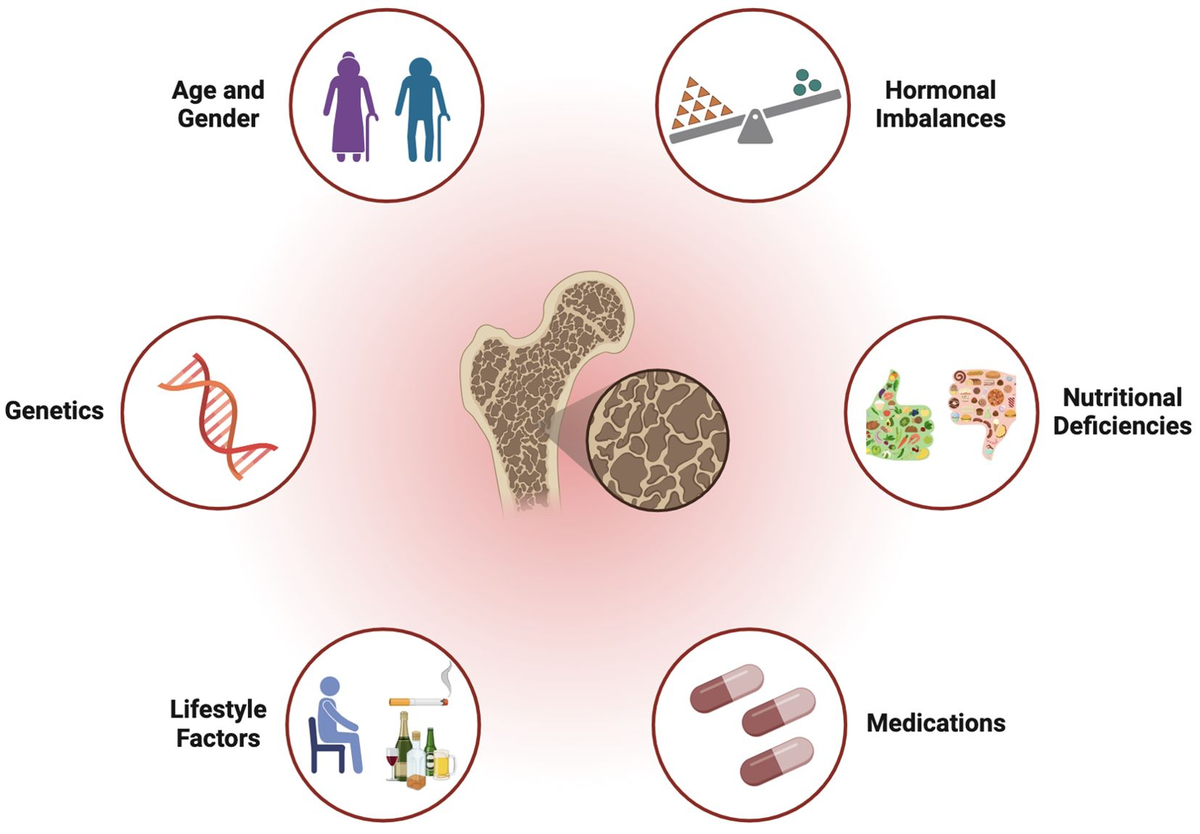 Frontiers | From gut to bone: deciphering the impact of gut