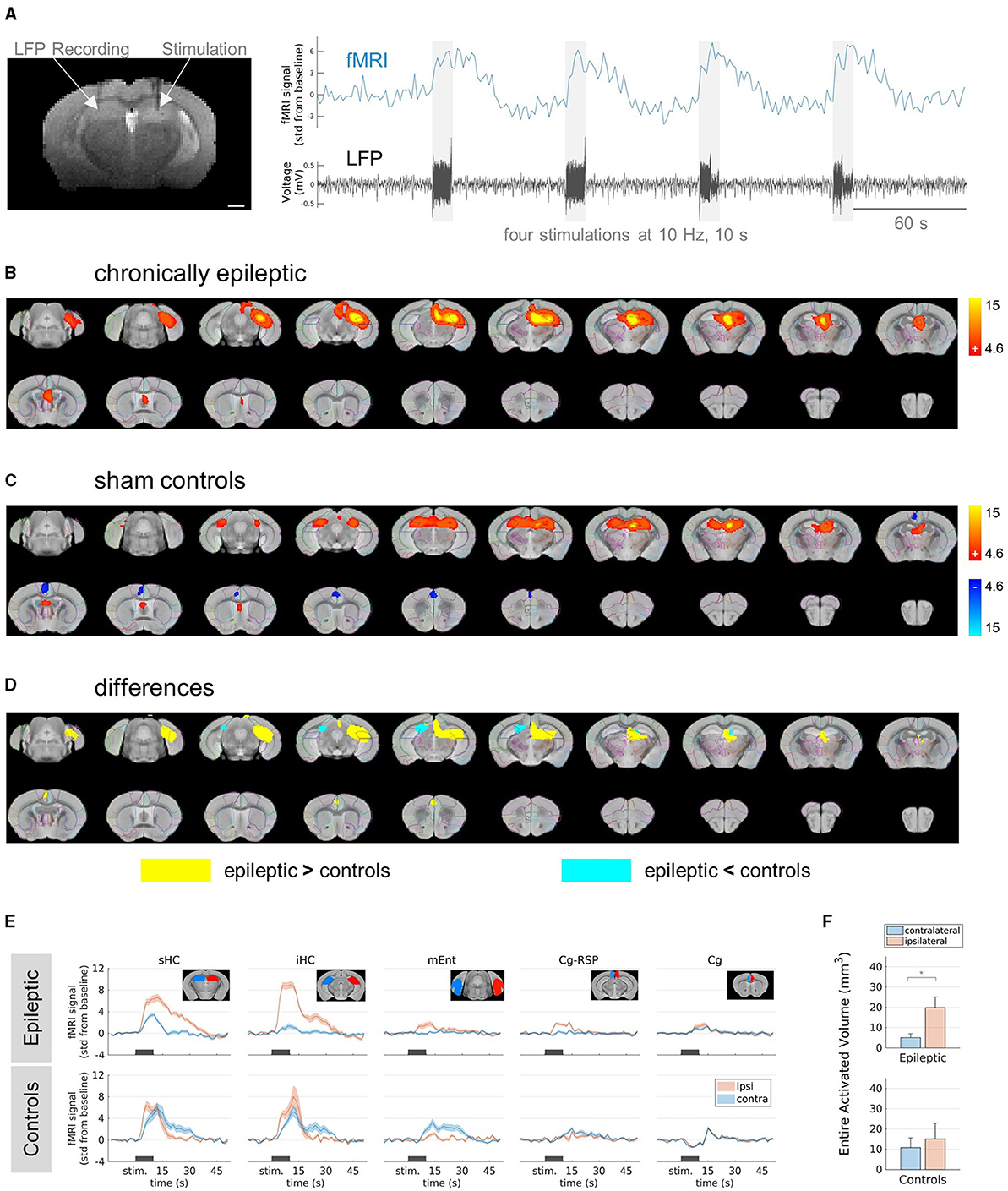 probing-hippocampal-stimulation-in-experimental-temporal-lobe-epilepsy-with-functional-mri-frontiers