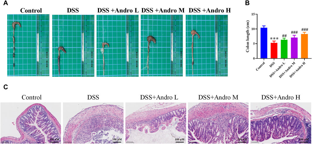 Frontiers | Protective effect of andrographolide against