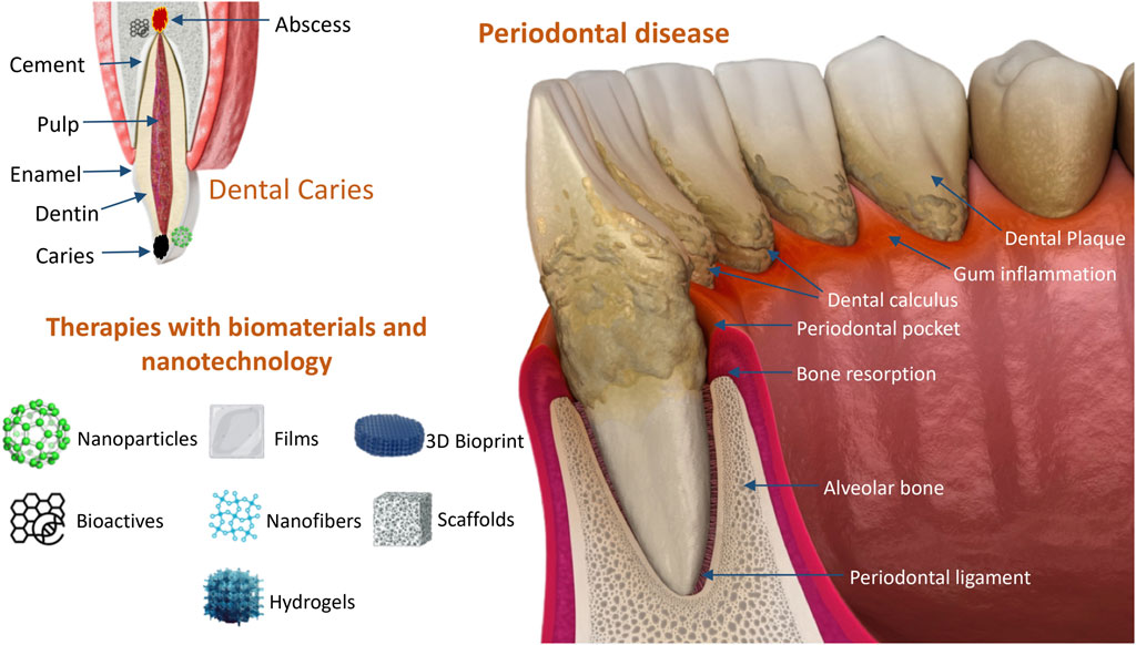 ペリオドンタル・デブライドメント = Periodontal debridem… 51+q2Cj71ZL._AC_SY200_QL15_.jpg