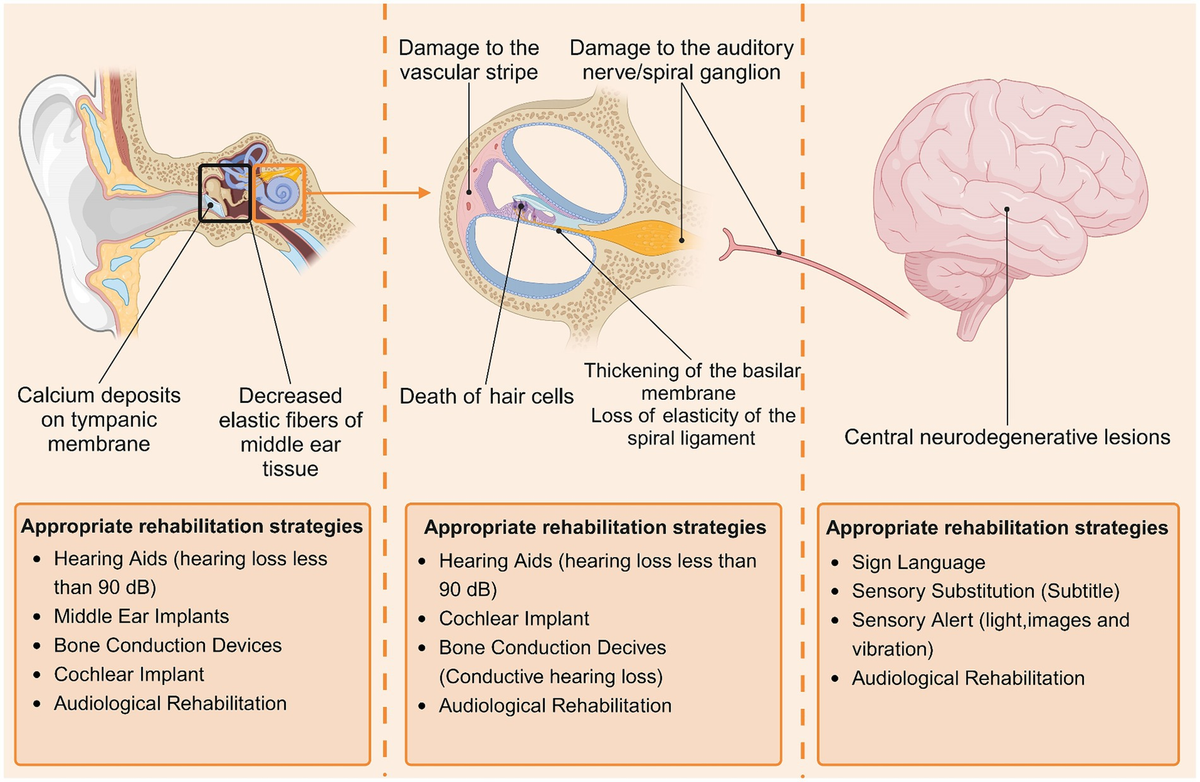 Frontiers | Age-related hearing loss in older adults