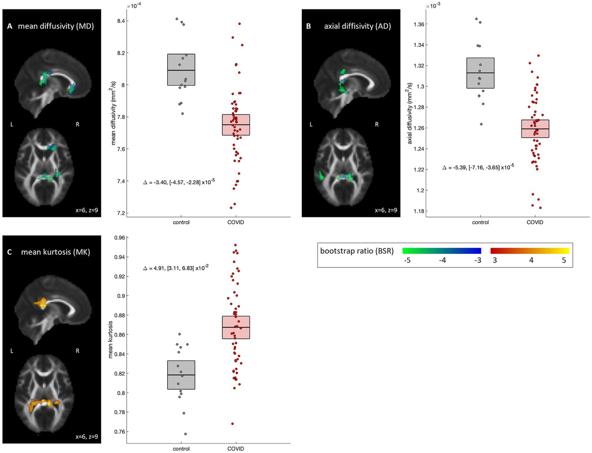 Effects of post-acute COVID-19 syndrome on cerebral white matter and emotional health among non-hospitalized individuals Effects of post-acute COVID-19 syndrome on cerebral white matter and emotional health among non-hospitalized individuals