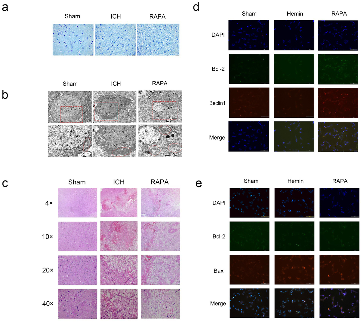 Frontiers | A crosstalk between autophagy and apoptosis in Frontiers | A crosstalk between autophagy and apoptosis in