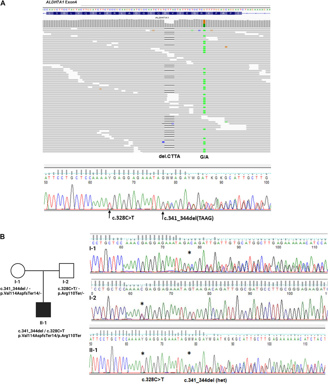 Frontiers Case report: Early (molecular) diagnosis is the clue