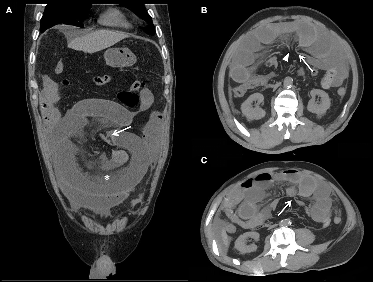 Frontiers | A prediction model to differentiate transient
