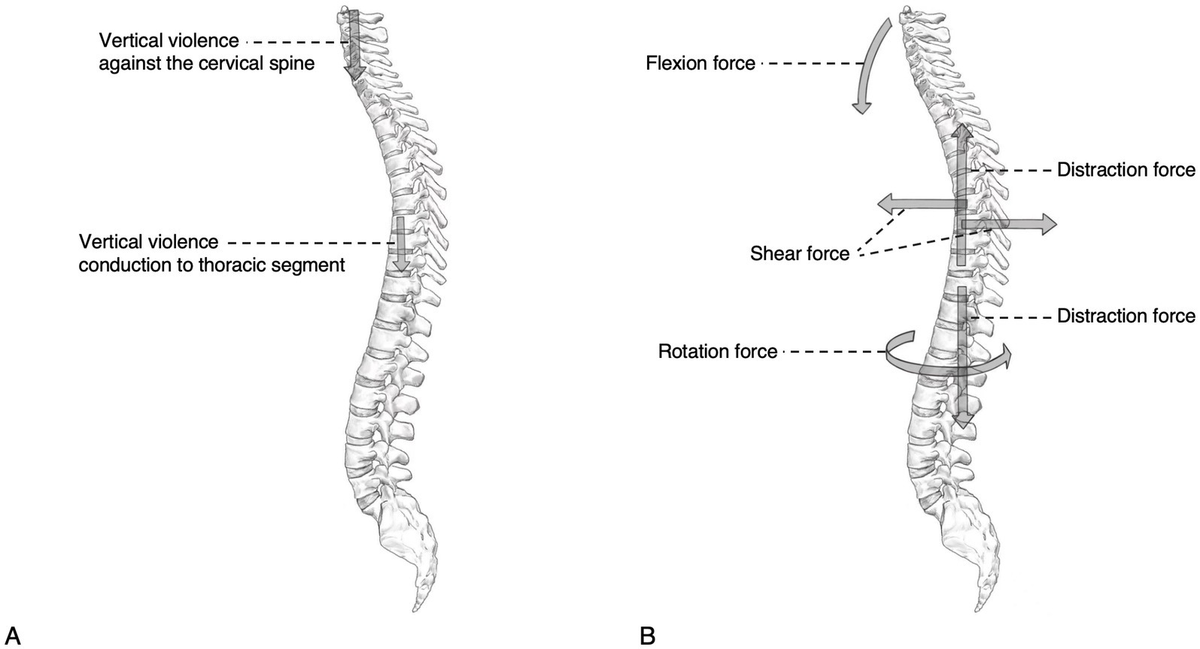 脊椎脊髄病学 = PRINCIPLES OF SPINAL DISORDERS Biomechanics of the Spine: Basic Concepts, Spinal Disorders