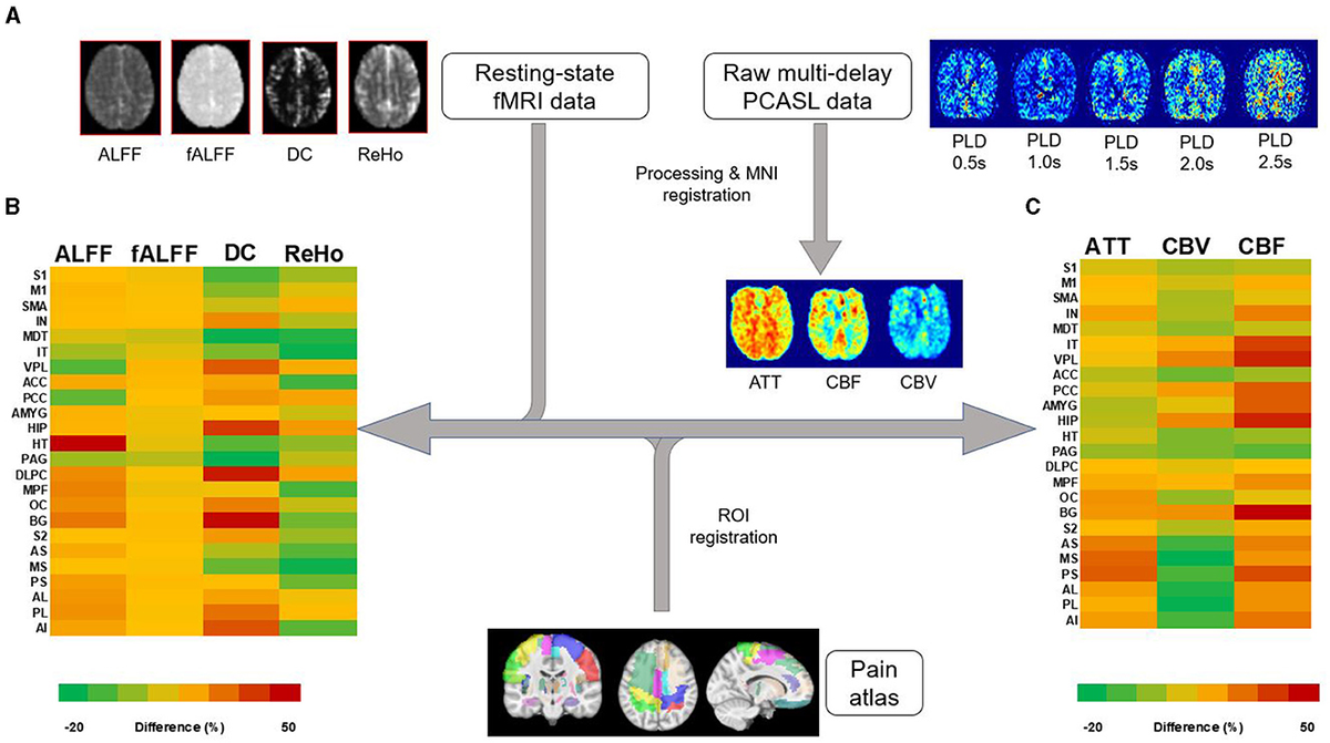 Crps: Current Diagnosis And Therapy (PROGRESS IN PAIN