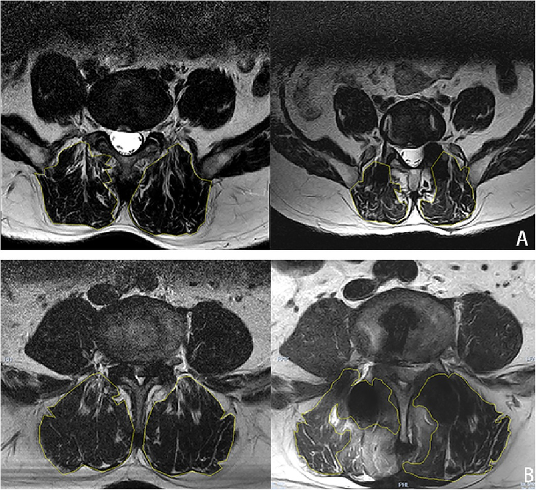サンプル Frontiers | Comparative analysis of clinical efficacy of