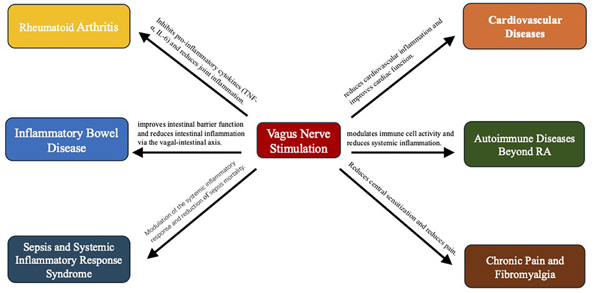 yu Frontiers | Non-invasive vagus nerve stimulation in anti