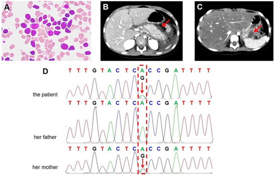 診断病理学：肝胆膵　２版 Hepatobiliary and Pancreas 91ZG051lS4L._UF350,350_QL80_.jpg
