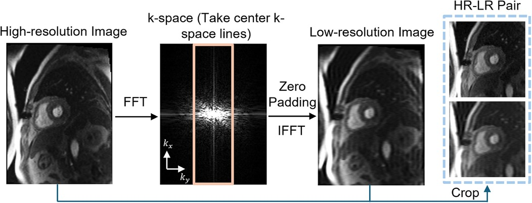 Frontiers | Conditional diffusion-generated super-resolution