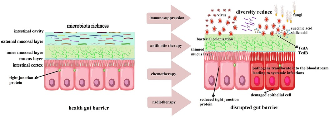 ゆん Frontiers | Microbiota modulation for infectious
