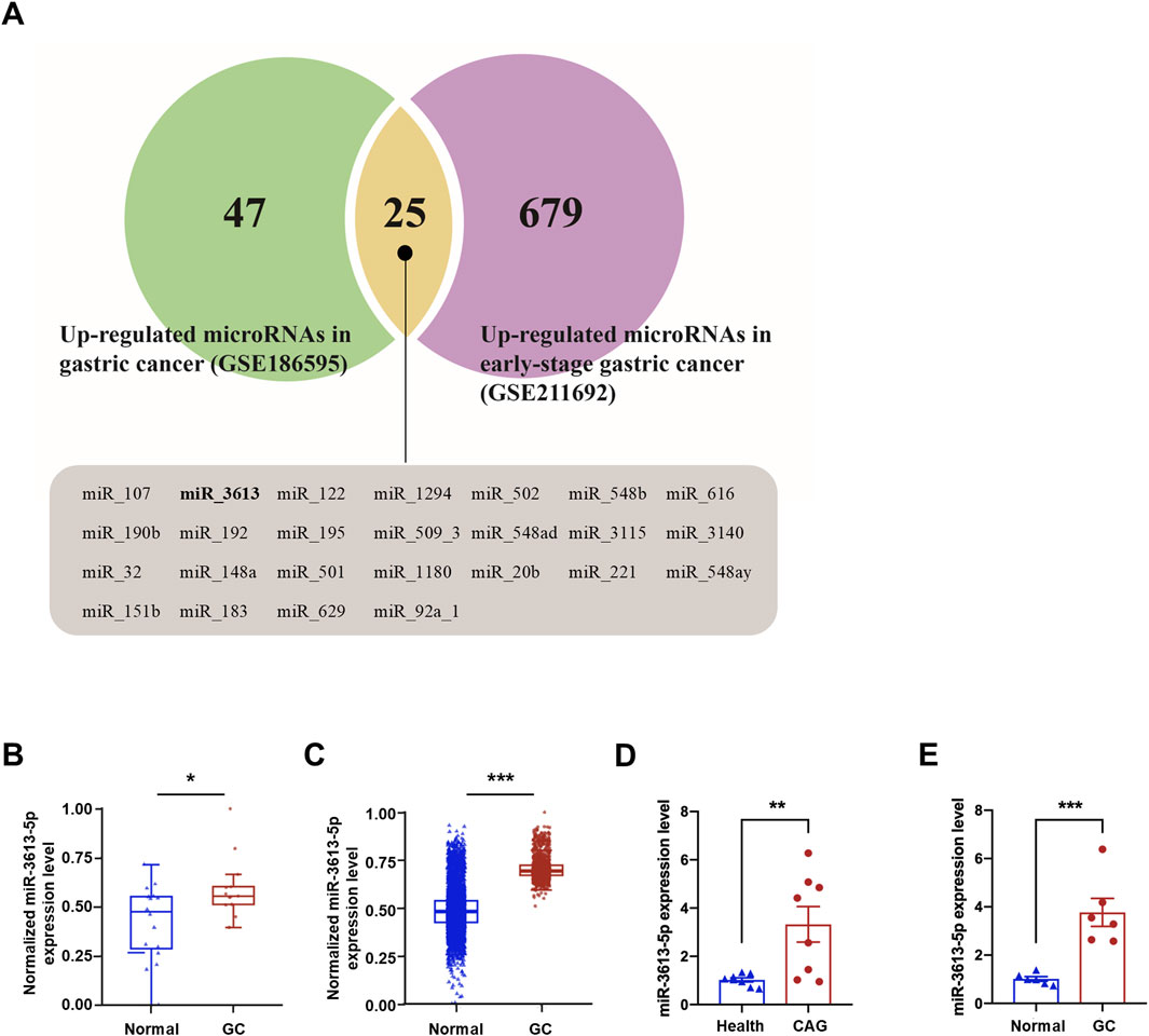 Frontiers | MiR-3613-5p targets AQP4 to promote the