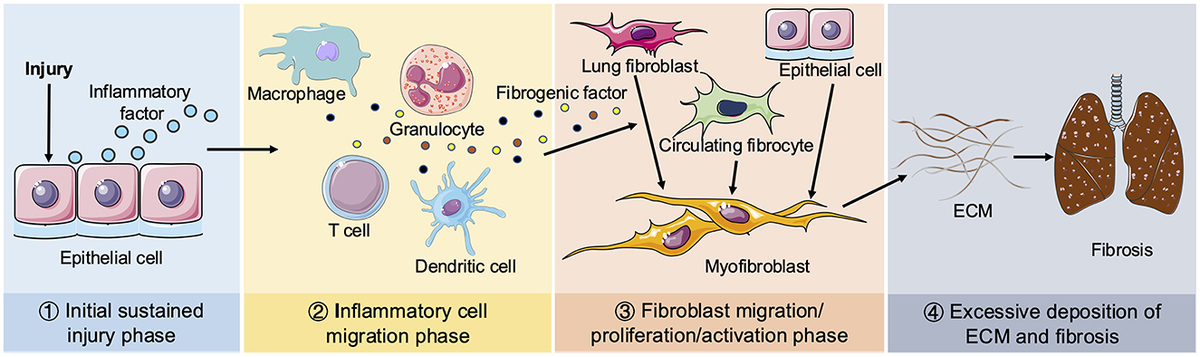 Frontiers | Nutritional insights into pulmonary fibrosis: a