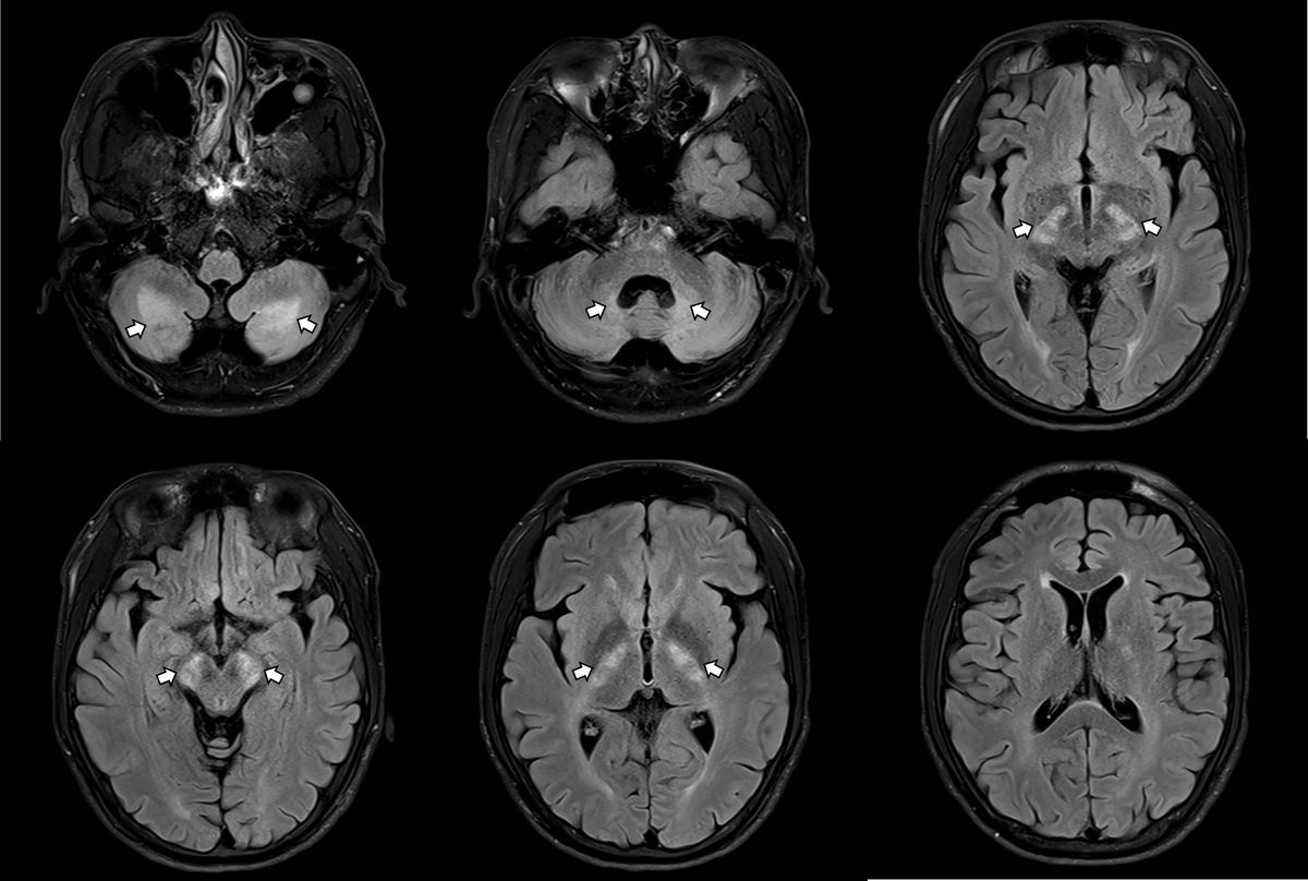 内科診断学 = MEDICAL DIAGNOSIS Differential Diagnosis in Neurology and Neurosurgery: A
