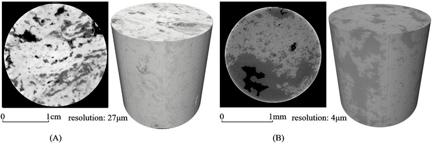 ジュニア Neutrophils and NETs in Pathophysiology and Treatment of
