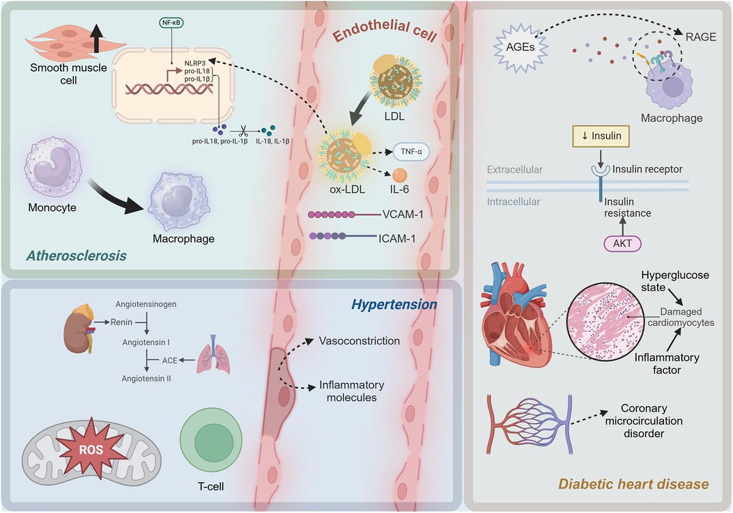 【ai】 Frontiers | Mechanisms of inflammatory microenvironment