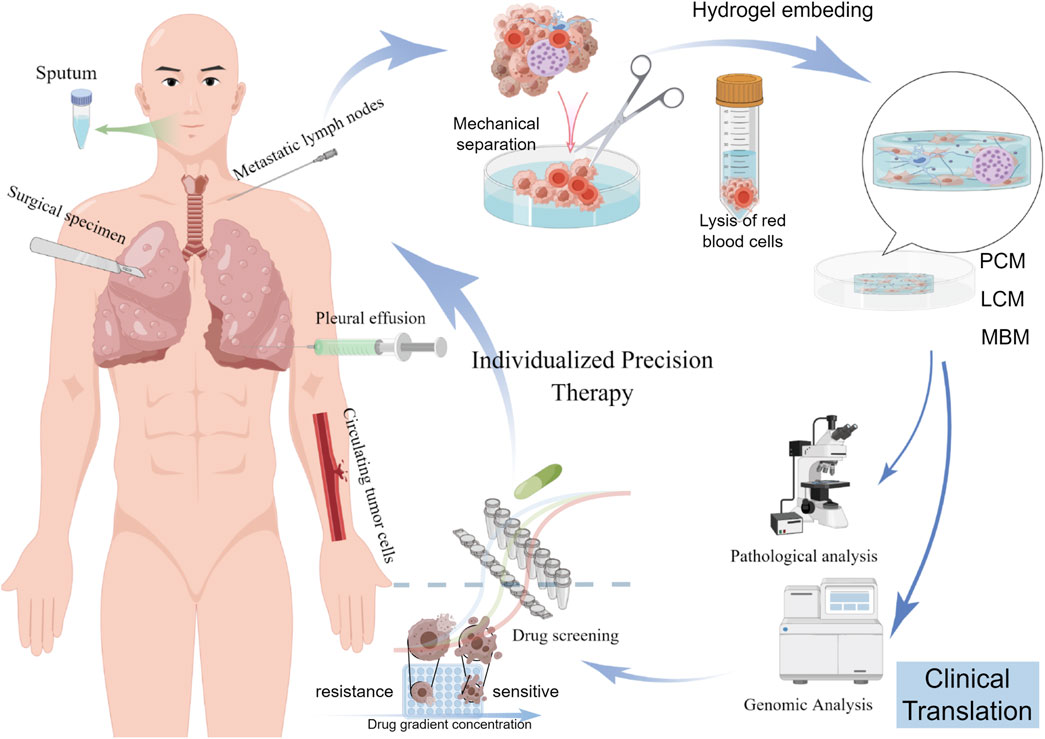 Frontiers | Bridging the gap: how patient-derived lung