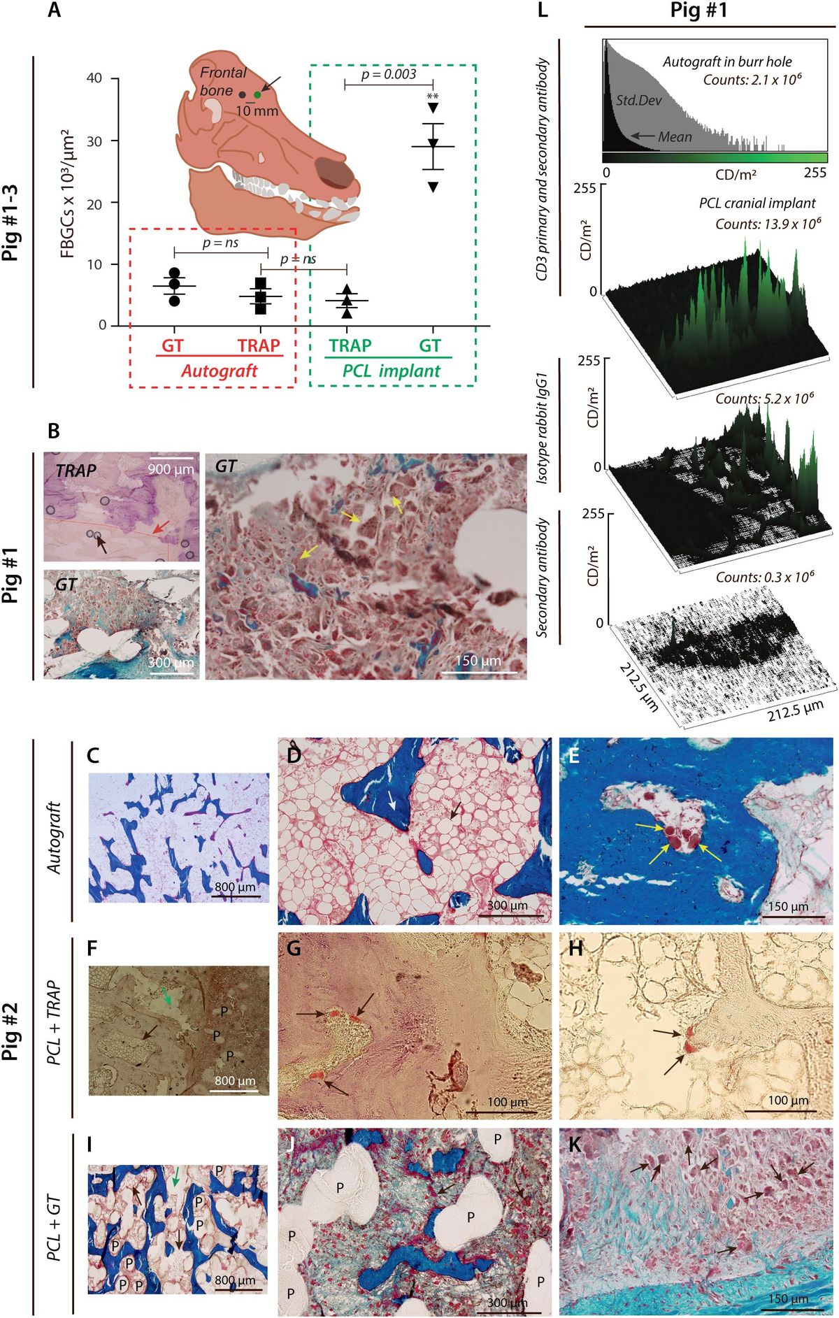 ル 年末のプロモーション Frontiers | Osteoclast-like multinucleated giant cells トイガン