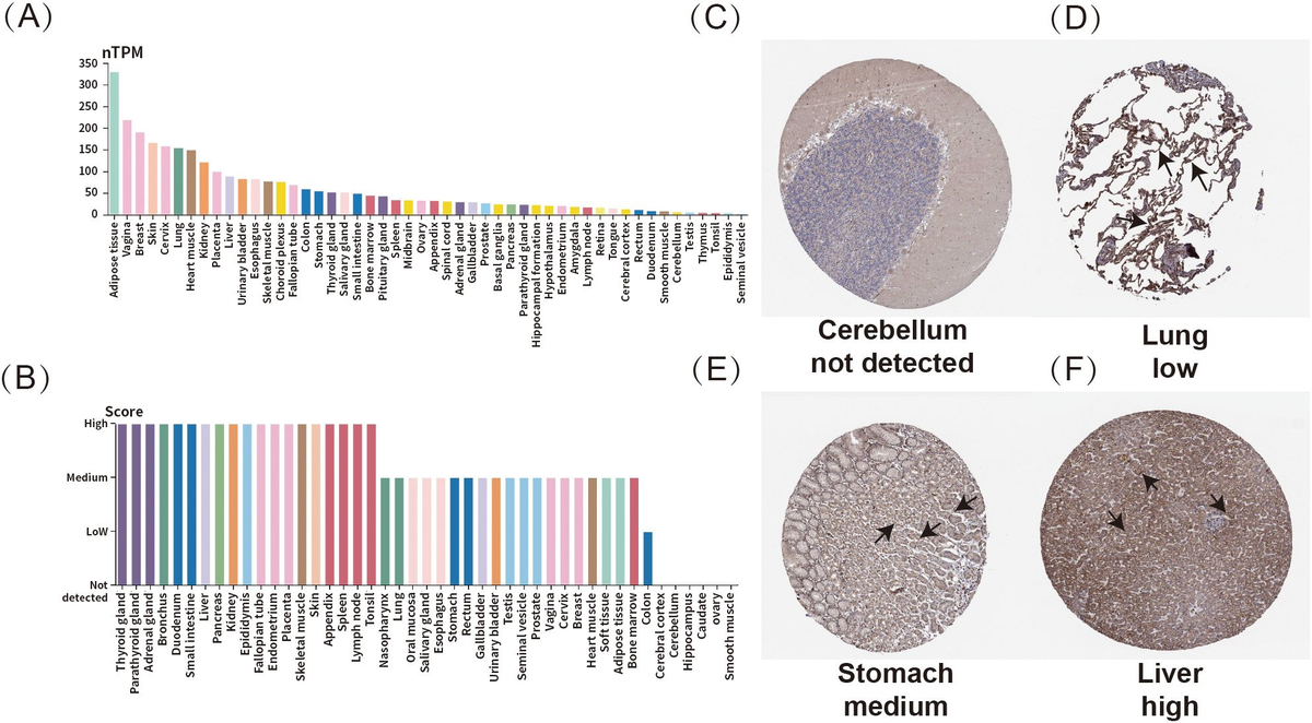Frontiers | Integrated pan-cancer analysis of ADM's role in