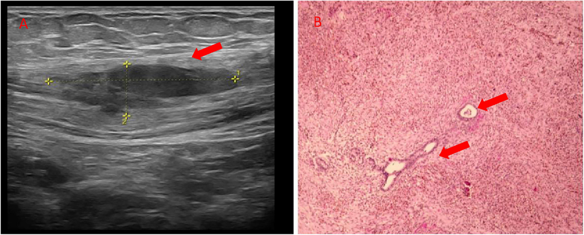 Frontiers Co existence of the abdominal wall and thoracic