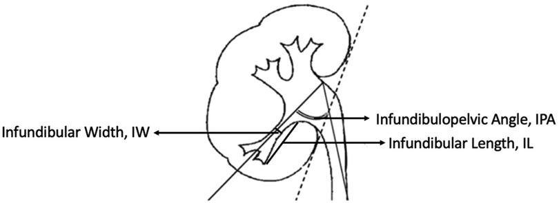 fsurg-12-1586882-g001.jpg