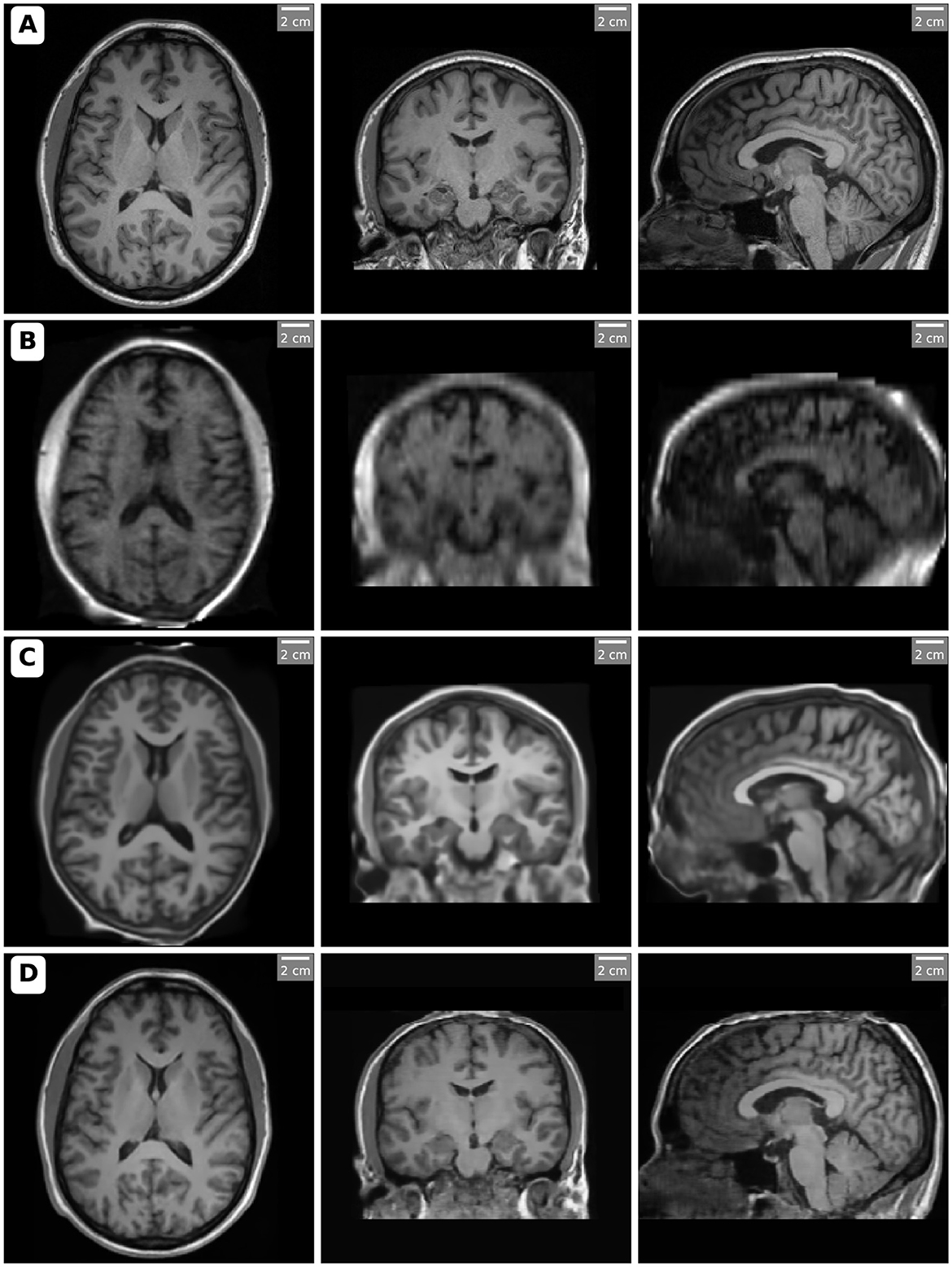 健康・医学 DIAGNOSTIC IMAGING BRAIN FireShot-Capture-037-.png