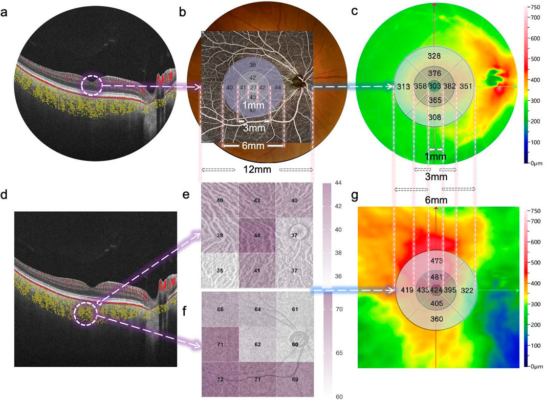 Frontiers | Early detection of retinal and choroidal