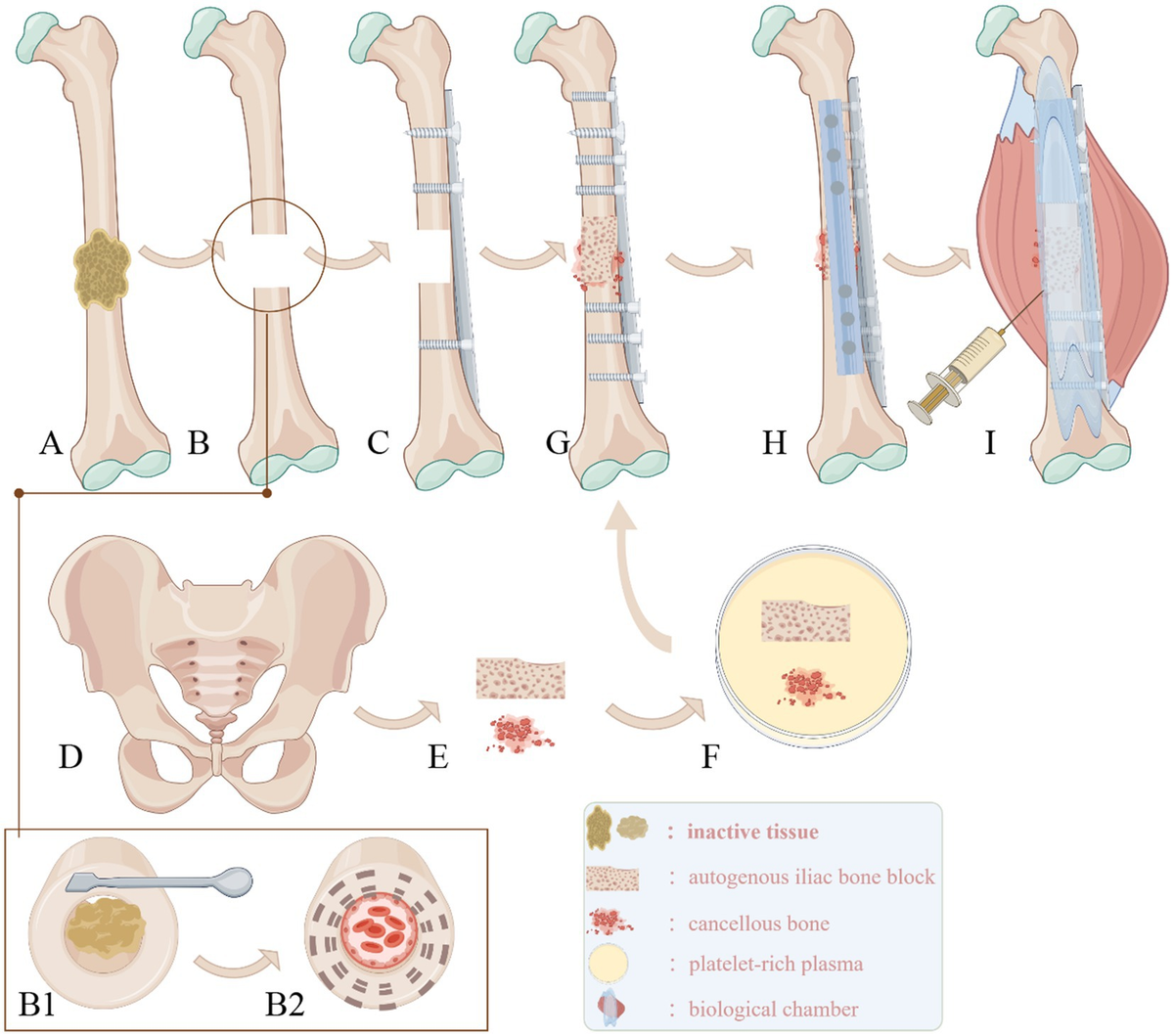 nabe190 MALFORMED / Confinement of＋3枚 Confinement of Flesh | Malformed | Dark Descent Records
